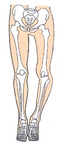���Ղ̘c�ݐ}�P