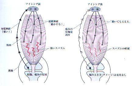 アイシング図3